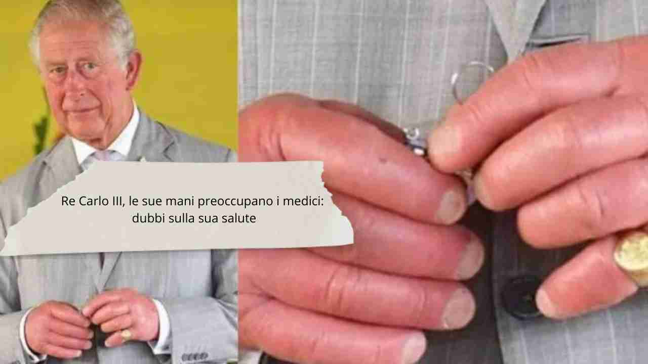 Re Carlo le sue condizioni di salute